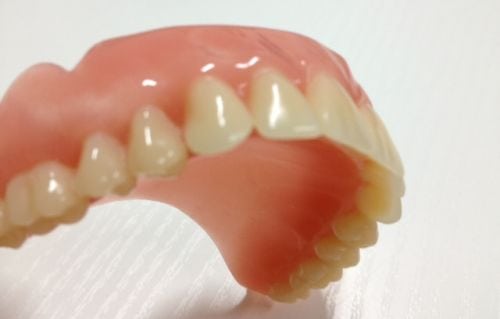 denture implant