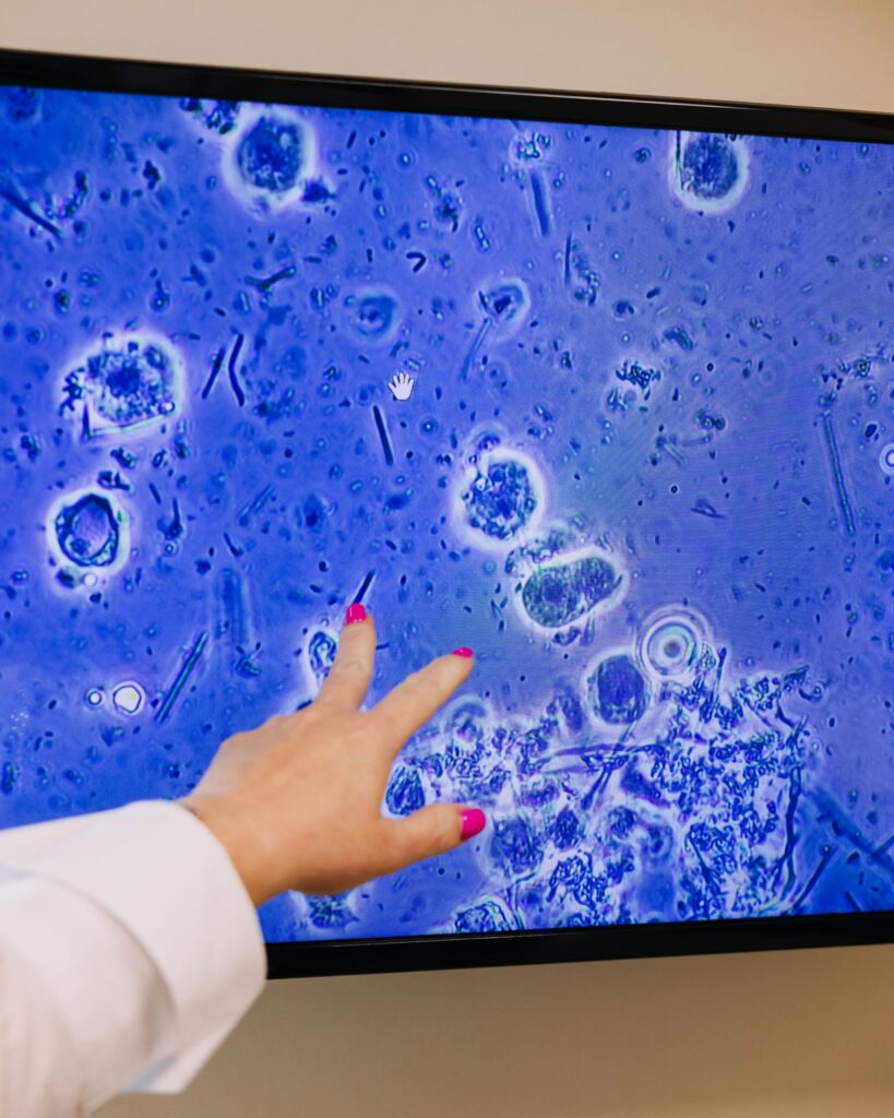 Magnified view of oral bacteria on a screen used for dental diagnostics and patient education