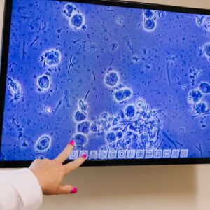 Dental professional reviewing oral microbiome samples on a microscope display screen